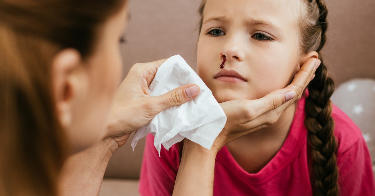 A young girl with a nose bleed