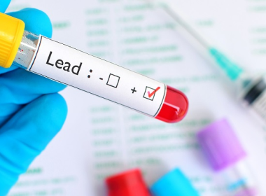 Test vial with the Word Lead checked